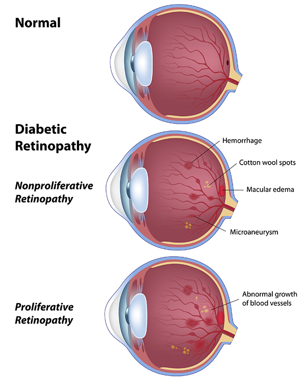 Old Greenwich Diabetic Eye Care